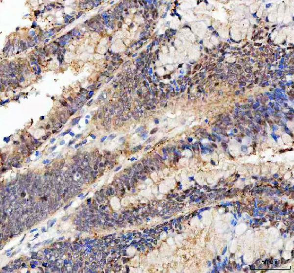 BAG1 Antibody in Immunohistochemistry (Paraffin) (IHC (P))