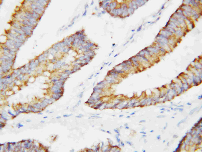 BCAT2 Antibody in Immunohistochemistry (Paraffin) (IHC (P))