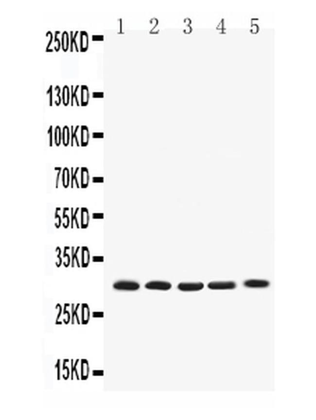 BCL-XL Antibody in Western Blot (WB)