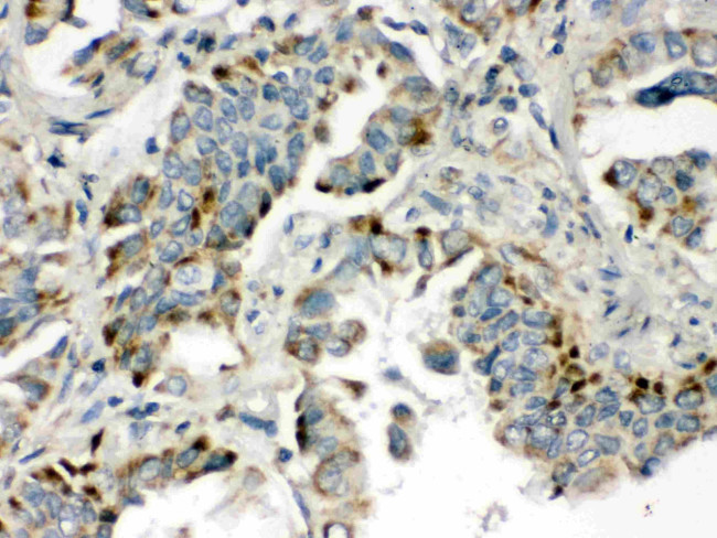 BMP5 Antibody in Immunohistochemistry (Paraffin) (IHC (P))