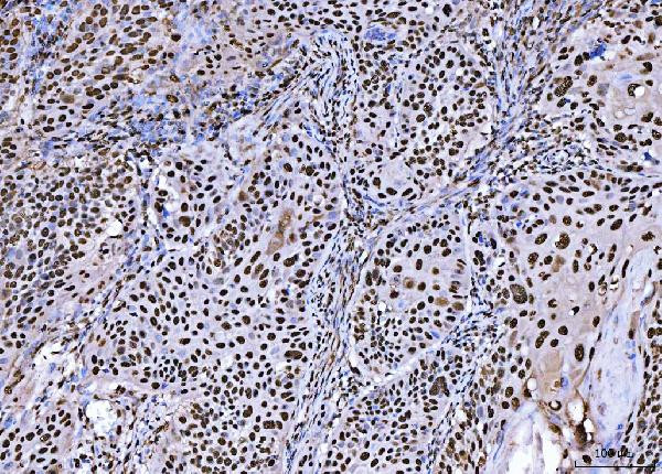 BRCA1 Antibody in Immunohistochemistry (Paraffin) (IHC (P))