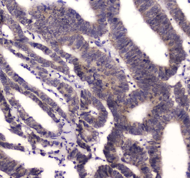 BRD7 Antibody in Immunohistochemistry (Paraffin) (IHC (P))
