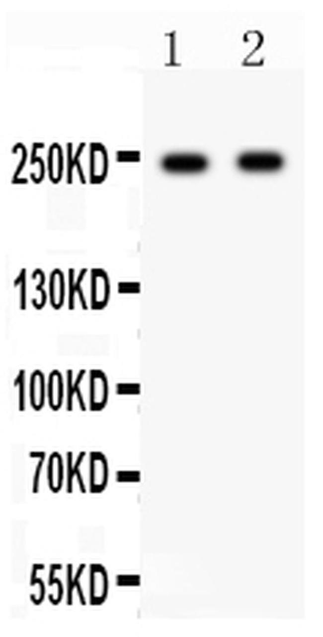 CaV1.3 Antibody in Western Blot (WB)