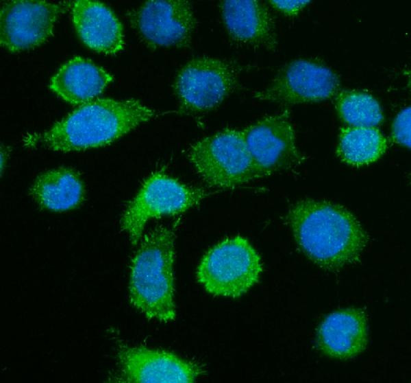 Caldesmon Antibody in Immunocytochemistry (ICC/IF)