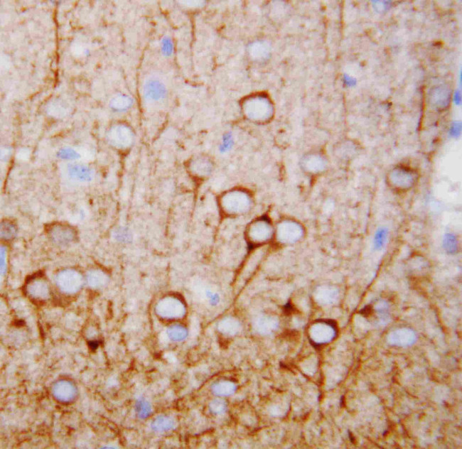 CaMKK alpha Antibody in Immunohistochemistry (Paraffin) (IHC (P))