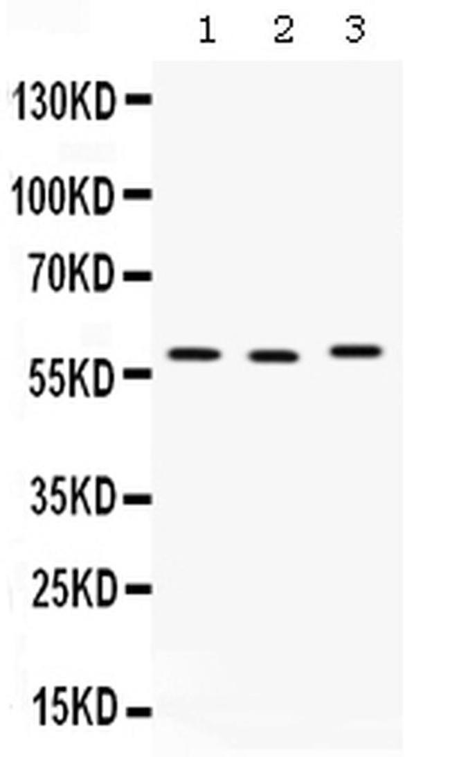CAP1 Antibody in Western Blot (WB)