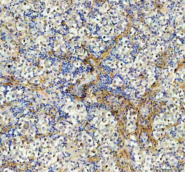 AAMP Antibody in Immunohistochemistry (Paraffin) (IHC (P))