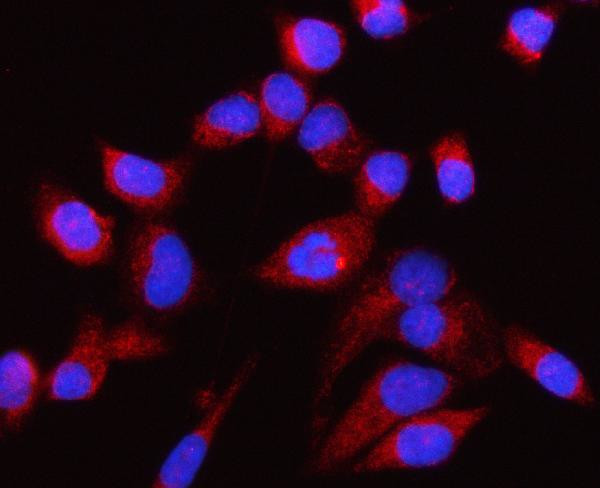 CP110 Antibody in Immunocytochemistry (ICC/IF)
