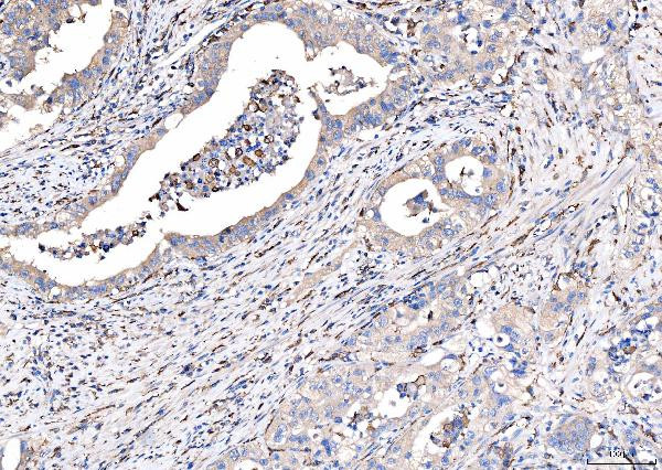 CD163 Antibody in Immunohistochemistry (Paraffin) (IHC (P))