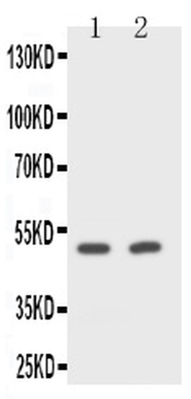 CD2 Antibody in Western Blot (WB)