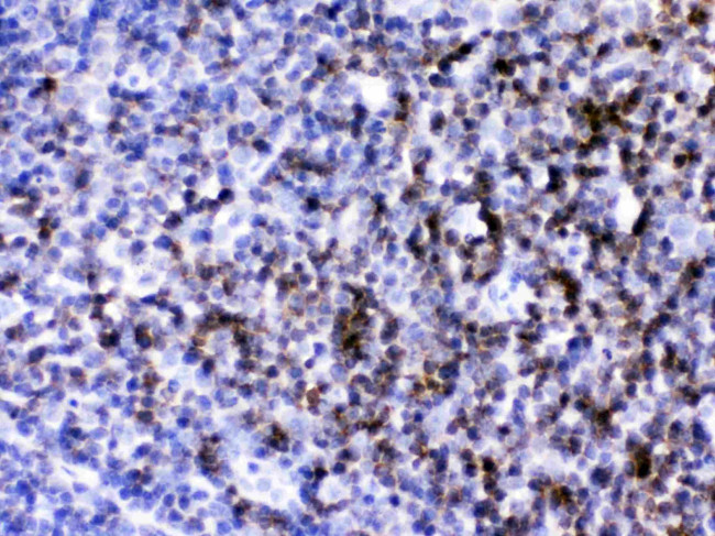 CD2 Antibody in Immunohistochemistry (Paraffin) (IHC (P))