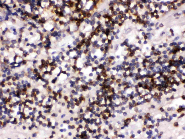 CD22 Antibody in Immunohistochemistry (Paraffin) (IHC (P))