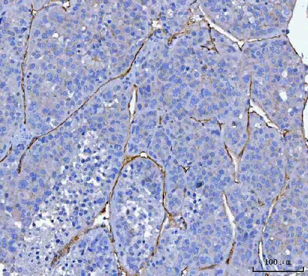 CD34 Antibody in Immunohistochemistry (Paraffin) (IHC (P))