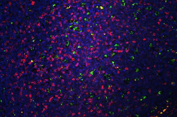 CD5 Antibody in Immunohistochemistry (Paraffin) (IHC (P))