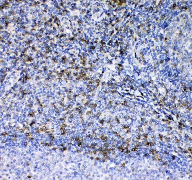 CD7 Antibody in Immunohistochemistry (Paraffin) (IHC (P))