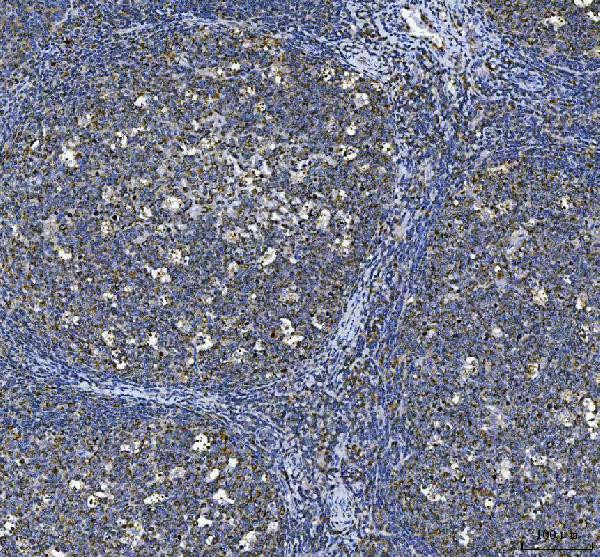 CD80 (B7-1) Antibody in Immunohistochemistry (Paraffin) (IHC (P))