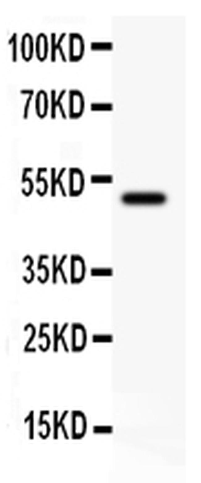 CD80 (B7-1) Antibody in Western Blot (WB)
