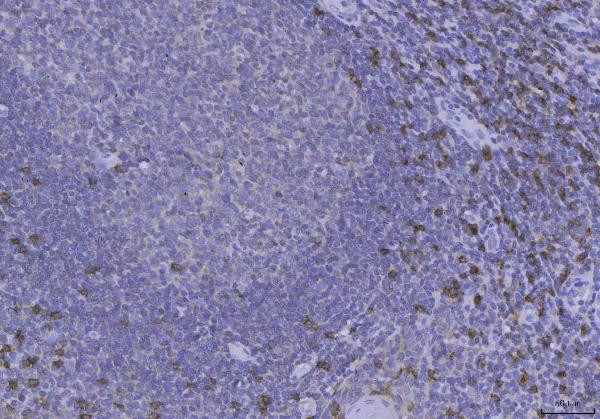 CD8 alpha Antibody in Immunohistochemistry (Paraffin) (IHC (P))