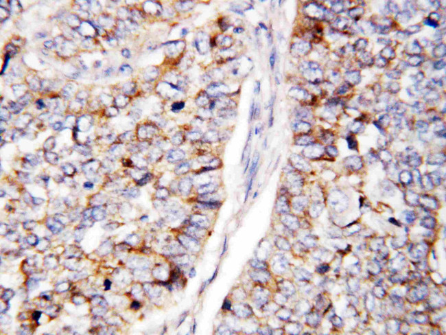 CDC25B Antibody in Immunohistochemistry (Paraffin) (IHC (P))