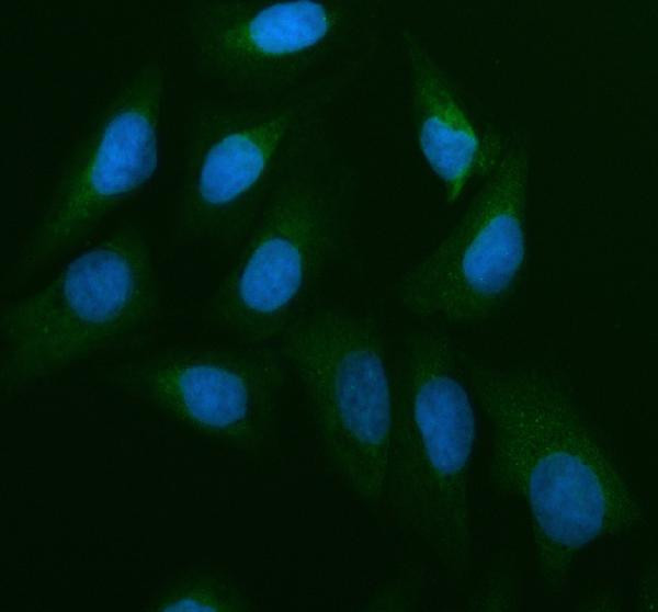 CDC25B Antibody in Immunocytochemistry (ICC/IF)