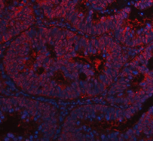 CDK4 Antibody in Immunohistochemistry (Paraffin) (IHC (P))