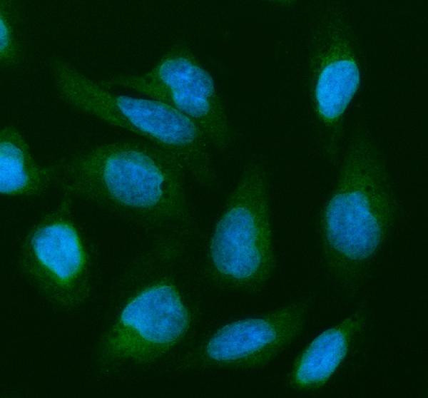 Cofilin 2 Antibody in Immunocytochemistry (ICC/IF)