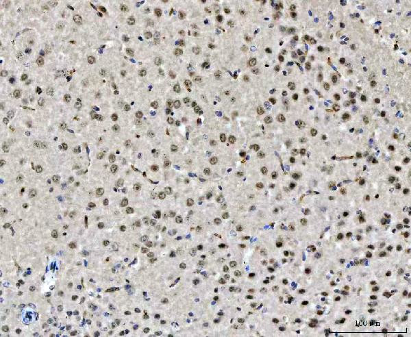 CHD2 Antibody in Immunohistochemistry (Paraffin) (IHC (P))