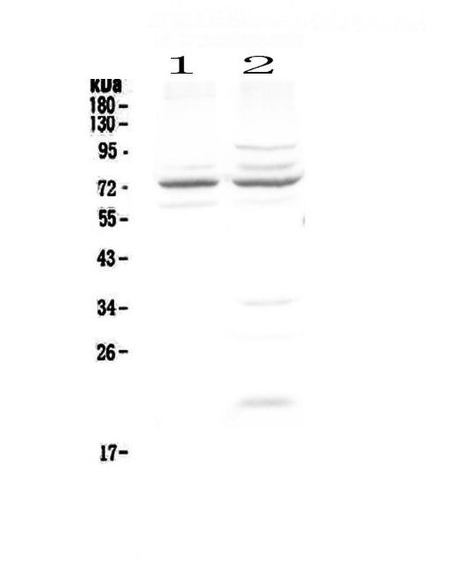 CHM Antibody in Western Blot (WB)