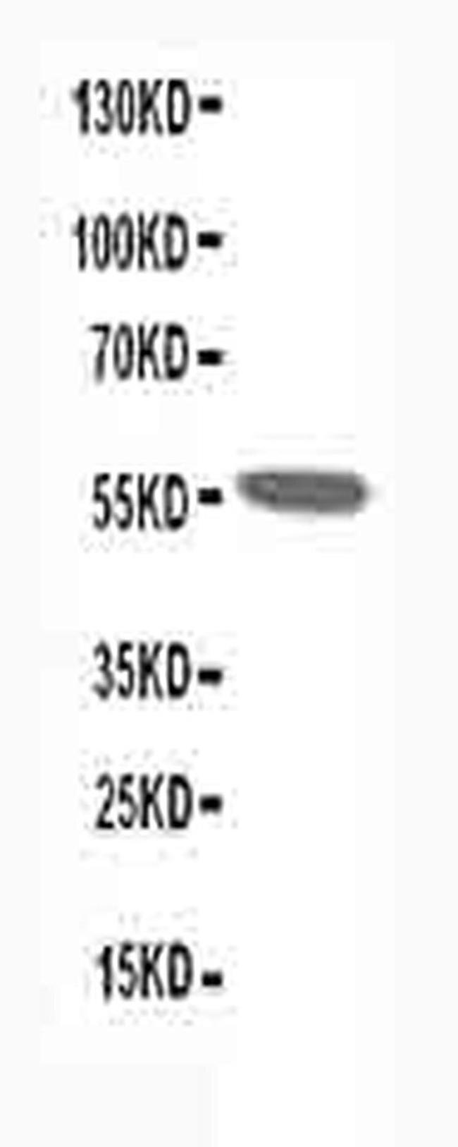 CHRNA1 Antibody in Western Blot (WB)