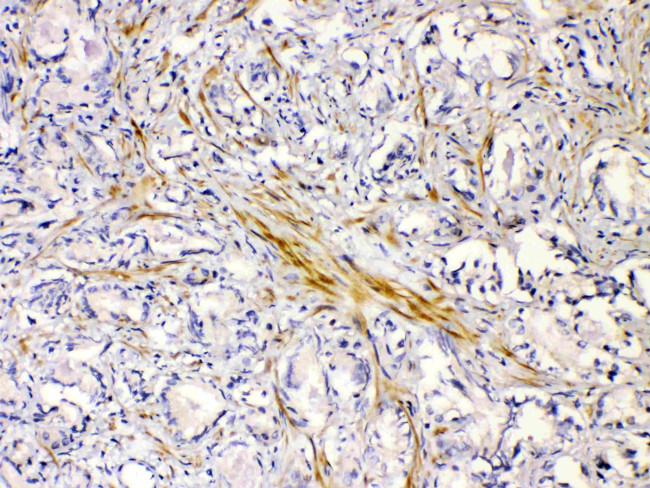 CHRNA5 Antibody in Immunohistochemistry (Paraffin) (IHC (P))