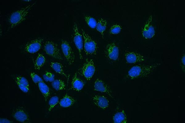 CLPX Polyclonal Antibody (PA5-79052)