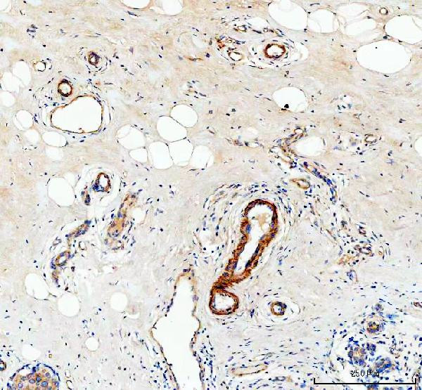 COL4A2 Antibody in Immunohistochemistry (Paraffin) (IHC (P))