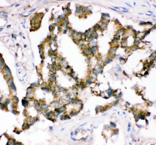CRK Antibody in Immunohistochemistry (Paraffin) (IHC (P))