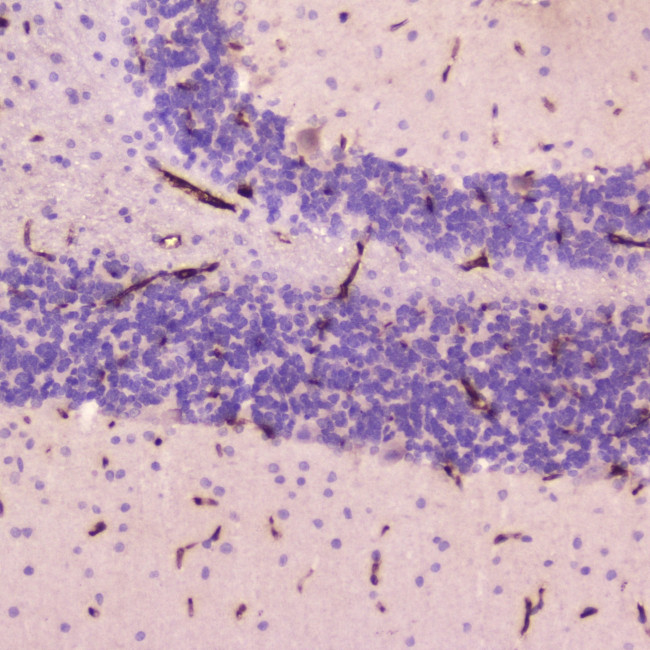 CRP Antibody in Immunohistochemistry (Paraffin) (IHC (P))