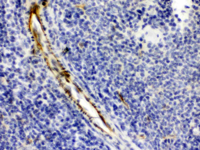 Alpha A Crystallin Antibody in Immunohistochemistry (Paraffin) (IHC (P))
