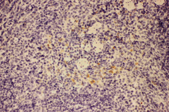 GM-CSF Antibody in Immunohistochemistry (Paraffin) (IHC (P))