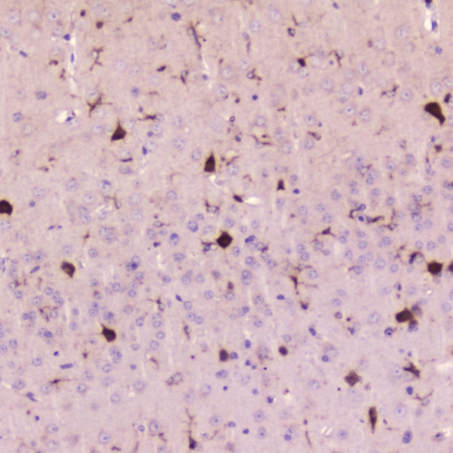 Cystatin C Antibody in Immunohistochemistry (Paraffin) (IHC (P))