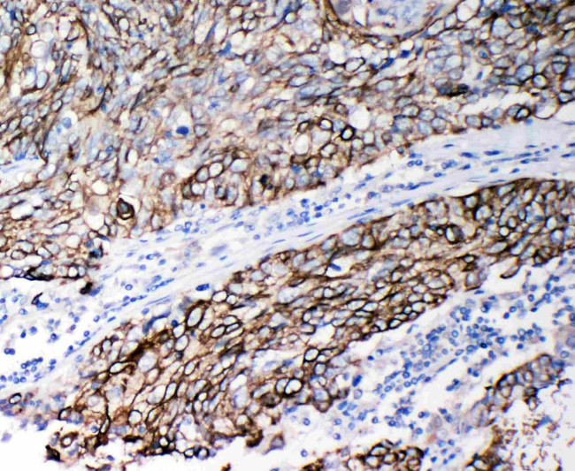 Cystatin B Antibody in Immunohistochemistry (Paraffin) (IHC (P))