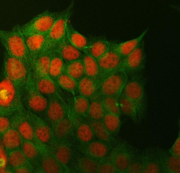 CtBP2 Antibody in Immunocytochemistry (ICC/IF)
