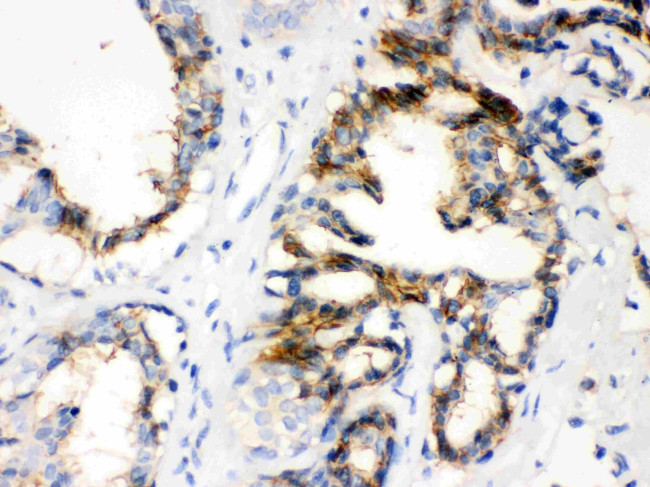 CTGF Antibody in Immunohistochemistry (Paraffin) (IHC (P))
