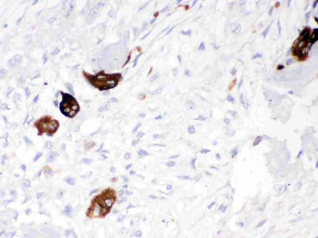 Cathepsin K Antibody in Immunohistochemistry (Paraffin) (IHC (P))