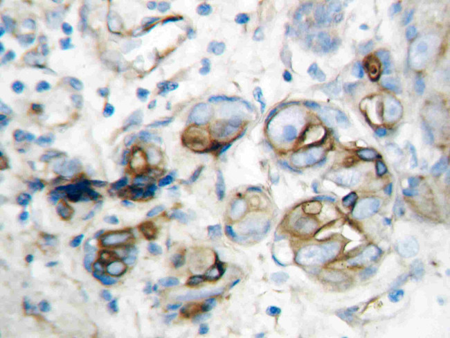 CXCL10 Antibody in Immunohistochemistry (Paraffin) (IHC (P))