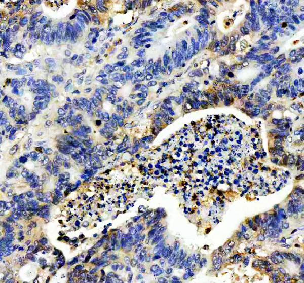 IL-8 (CXCL8) Antibody in Immunohistochemistry (Paraffin) (IHC (P))