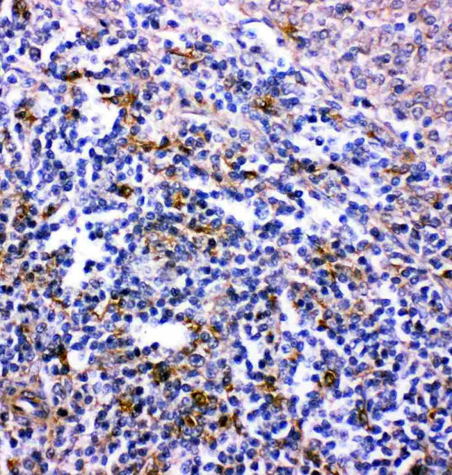 CXCR6 Antibody in Immunohistochemistry (Paraffin) (IHC (P))