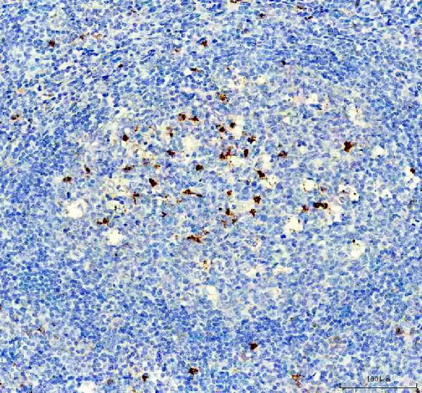 NOX2 Antibody in Immunohistochemistry (Paraffin) (IHC (P))
