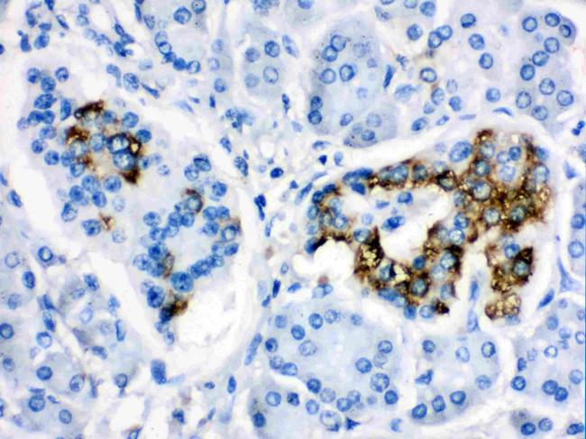 CYP24A1 Antibody in Immunohistochemistry (Paraffin) (IHC (P))