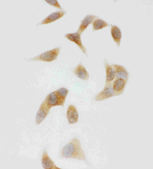 CYP2U1 Antibody in Immunocytochemistry (ICC/IF)