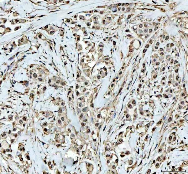 DCK Antibody in Immunohistochemistry (Paraffin) (IHC (P))