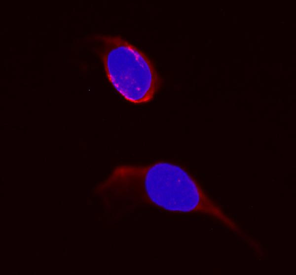 DHFR Antibody in Immunocytochemistry (ICC/IF)