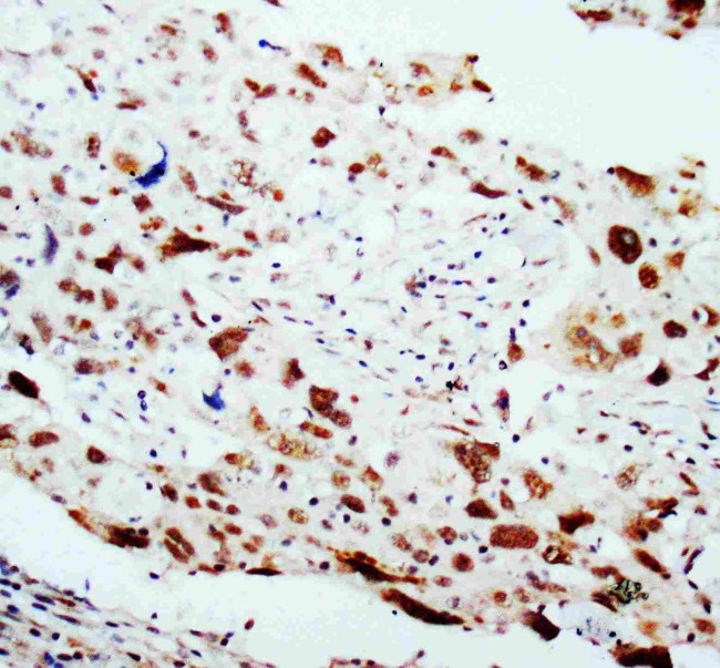 HSP40 Antibody in Immunohistochemistry (Paraffin) (IHC (P))